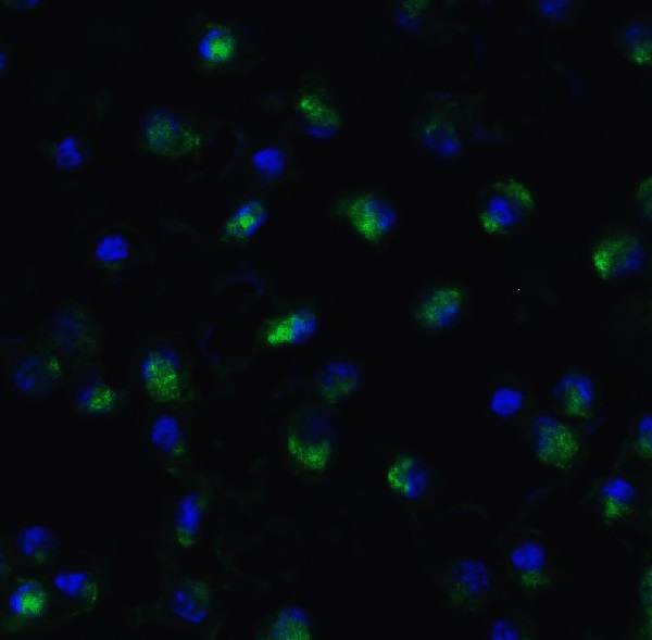 Immunocytochemistry/ Immunofluorescence - Anti-TET1 antibody - C-terminal (AB191698), expandable thumbnail