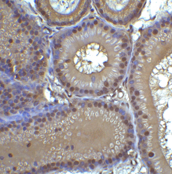 Immunohistochemistry (Formalin/PFA-fixed paraffin-embedded sections) - Anti-TET1 antibody - C-terminal (ab191698), expandable thumbnail