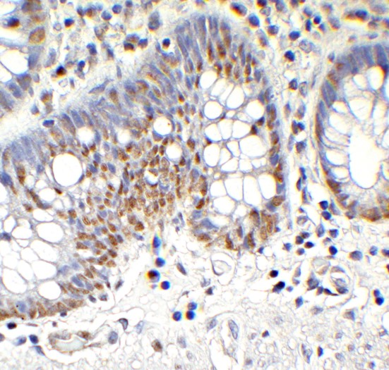 Immunohistochemistry (Formalin/PFA-fixed paraffin-embedded sections) - Anti-TET1 antibody - C-terminal (ab191698), expandable thumbnail