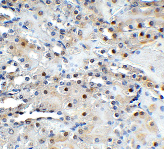 Immunohistochemistry (Formalin/PFA-fixed paraffin-embedded sections) - Anti-TET1 antibody - C-terminal (ab191698), expandable thumbnail