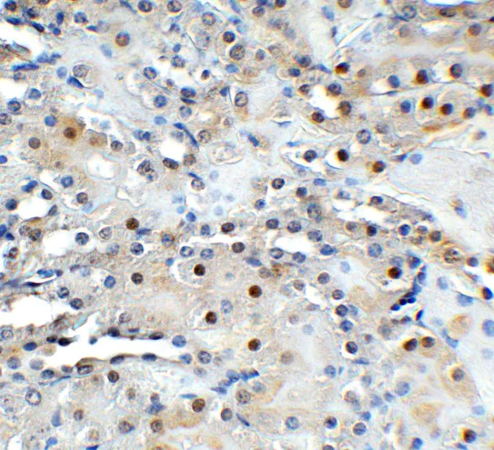 Immunohistochemistry (Formalin/PFA-fixed paraffin-embedded sections) - Anti-TET1 antibody - C-terminal (AB191698)