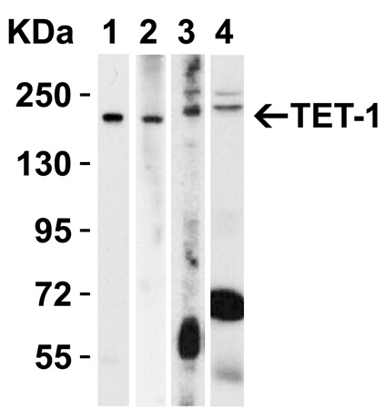 Western blot - Anti-TET1 antibody - C-terminal (AB191698), expandable thumbnail