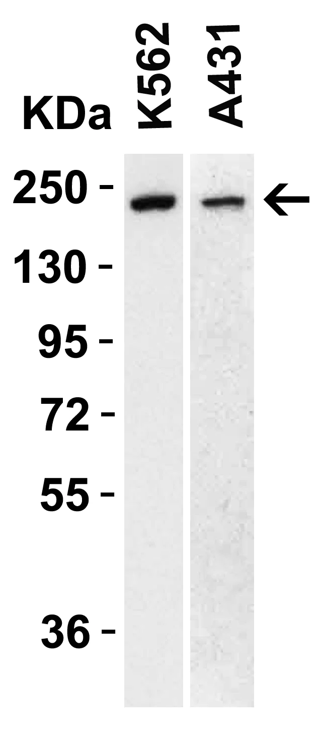 Western blot - Anti-TET1 antibody - C-terminal (AB191698)