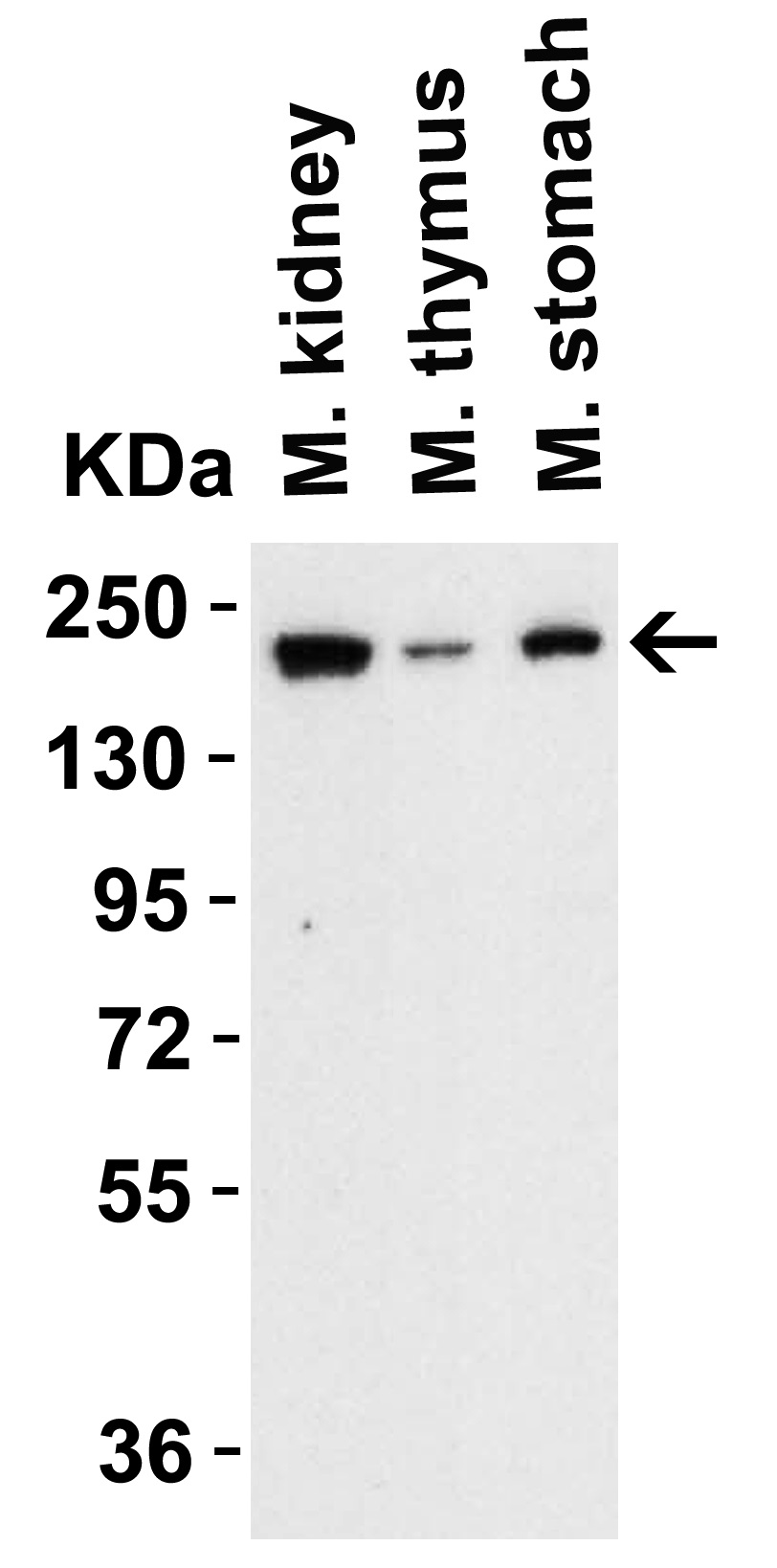Western blot - Anti-TET1 antibody - C-terminal (AB191698), expandable thumbnail