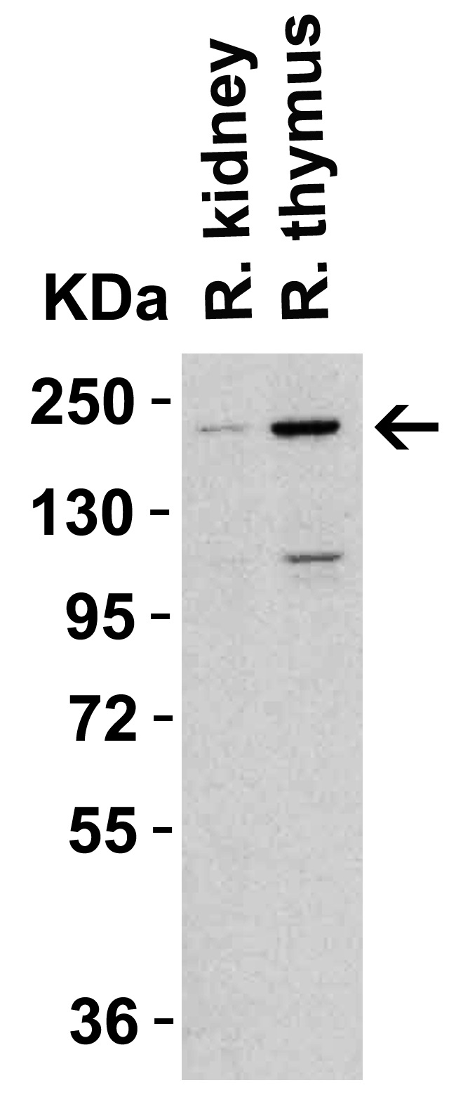 Western blot - Anti-TET1 antibody - C-terminal (AB191698), expandable thumbnail