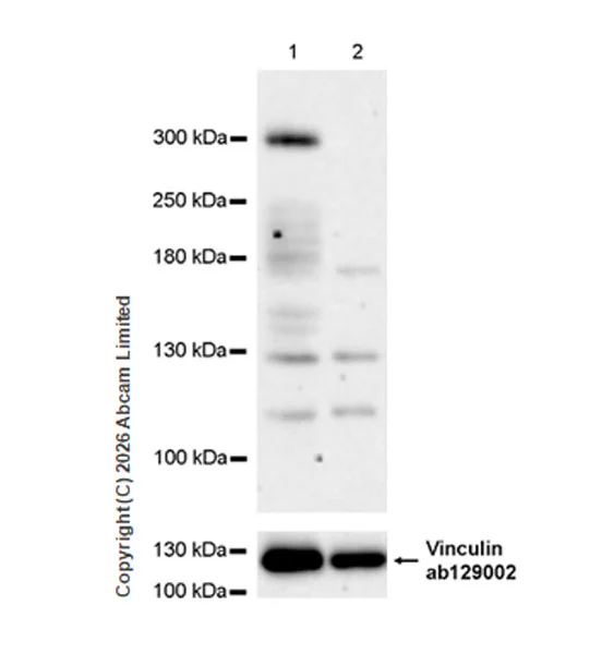 Western blot - Anti-TET1 antibody [EPR30558-579] (AB325925)