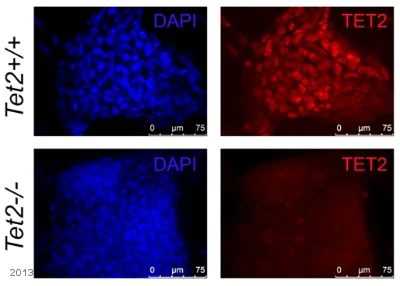 Immunocytochemistry/ Immunofluorescence - Anti-Tet2 antibody (AB124297)