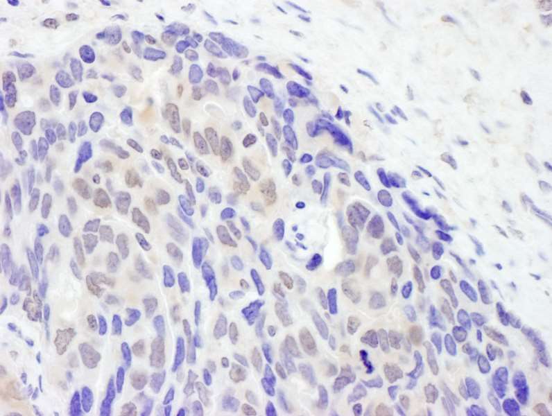 Immunohistochemistry (Formalin/PFA-fixed paraffin-embedded sections) - Anti-Tet2 antibody (AB245287)