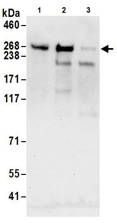 Western blot - Anti-Tet2 antibody (AB245287)