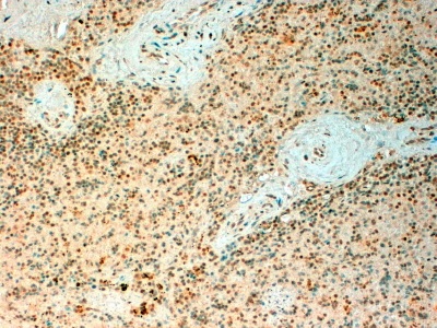 Immunohistochemistry (Formalin/PFA-fixed paraffin-embedded sections) - Anti-Tet2 antibody (AB99432)