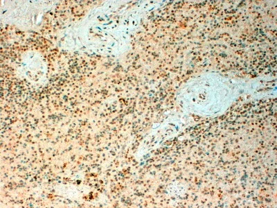 Immunohistochemistry (Formalin/PFA-fixed paraffin-embedded sections) - Anti-Tet2 antibody (AB99432)