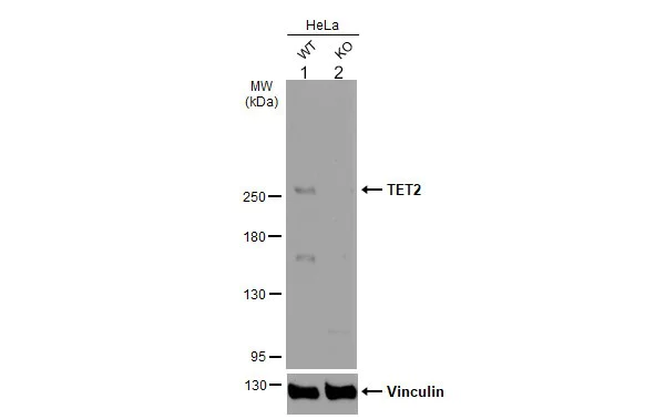 Western blot - Anti-Tet2 antibody - N-terminal (AB230358)