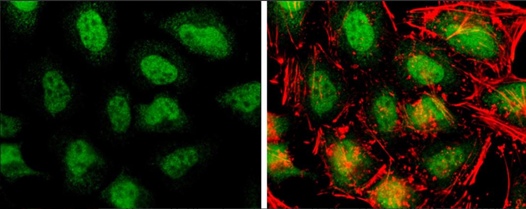Immunocytochemistry/ Immunofluorescence - Anti-TET3 antibody (AB153724), expandable thumbnail