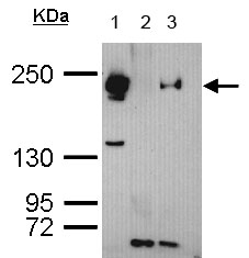 Immunoprecipitation - Anti-TET3 antibody (AB153724), expandable thumbnail