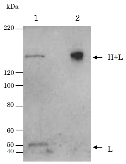 Western blot - Anti-Tetanus Toxin antibody [TH-11] (AB278064)