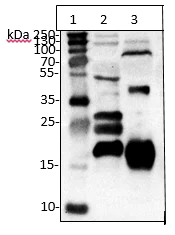 Western blot - Anti-Tetranectin antibody [5B7] (AB51883)