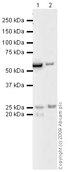 Western blot - Anti-Tetranectin antibody [5B7] (AB51883)