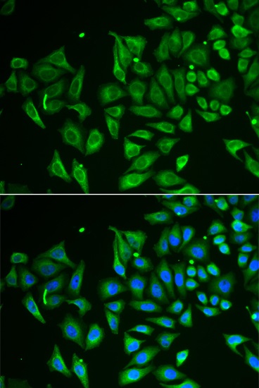Immunocytochemistry/ Immunofluorescence - Anti-Tetranectin antibody (AB202134)
