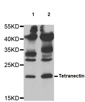 Western blot - Anti-Tetranectin antibody (AB202134)