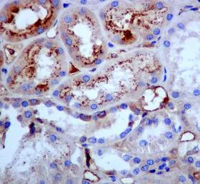 Immunohistochemistry (Formalin/PFA-fixed paraffin-embedded sections) - Anti-Tetranectin antibody [EPR3067] (AB108999)