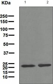Anti-Tetranectin antibody [EPR3067]