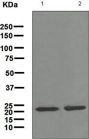 Western blot - Anti-Tetranectin antibody [EPR3067] (AB108999)