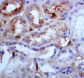 Immunohistochemistry (Formalin/PFA-fixed paraffin-embedded sections) - Anti-Tetranectin antibody [EPR3067] - BSA and Azide free (AB232500)