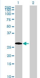 Western blot - Anti-TEX101 antibody (AB69522)