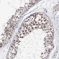 Immunohistochemistry (Formalin/PFA-fixed paraffin-embedded sections) - Anti-TEX12 antibody (AB122455)