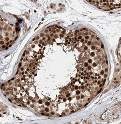 Immunohistochemistry (Formalin/PFA-fixed paraffin-embedded sections) - Anti-TEX15 antibody (AB122364)
