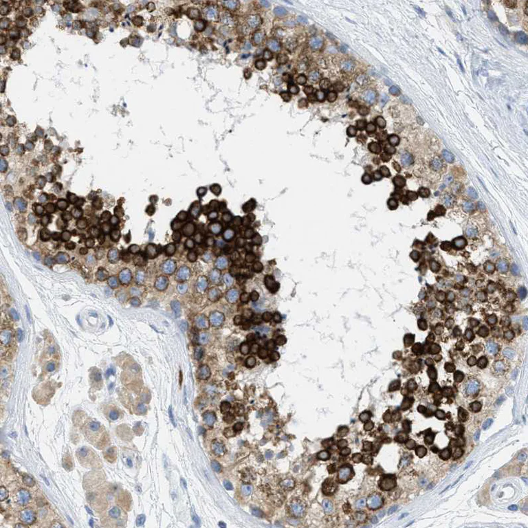 Immunohistochemistry (Formalin/PFA-fixed paraffin-embedded sections) - Anti-TEX264 antibody (AB272575)