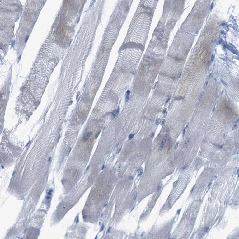 Immunohistochemistry (Formalin/PFA-fixed paraffin-embedded sections) - Anti-TEX264 antibody (AB272575)