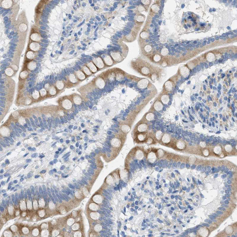 Immunohistochemistry (Formalin/PFA-fixed paraffin-embedded sections) - Anti-TEX264 antibody (AB272575)