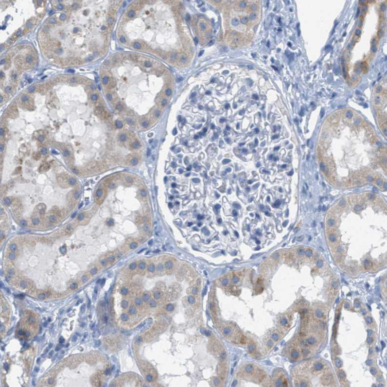 Immunohistochemistry (Formalin/PFA-fixed paraffin-embedded sections) - Anti-TEX264 antibody (AB272575)