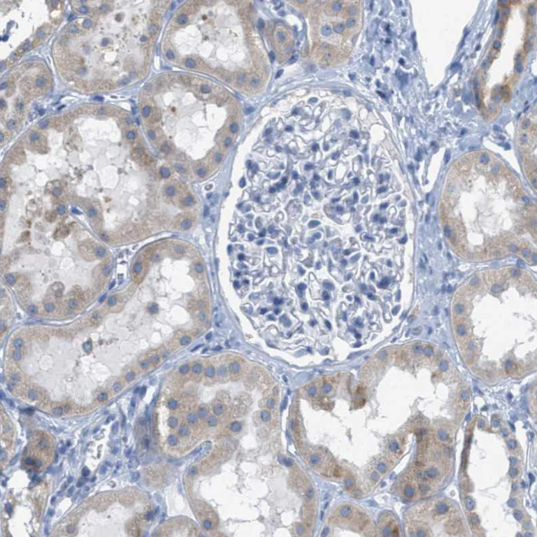 Immunohistochemistry (Formalin/PFA-fixed paraffin-embedded sections) - Anti-TEX264 antibody (AB272575)