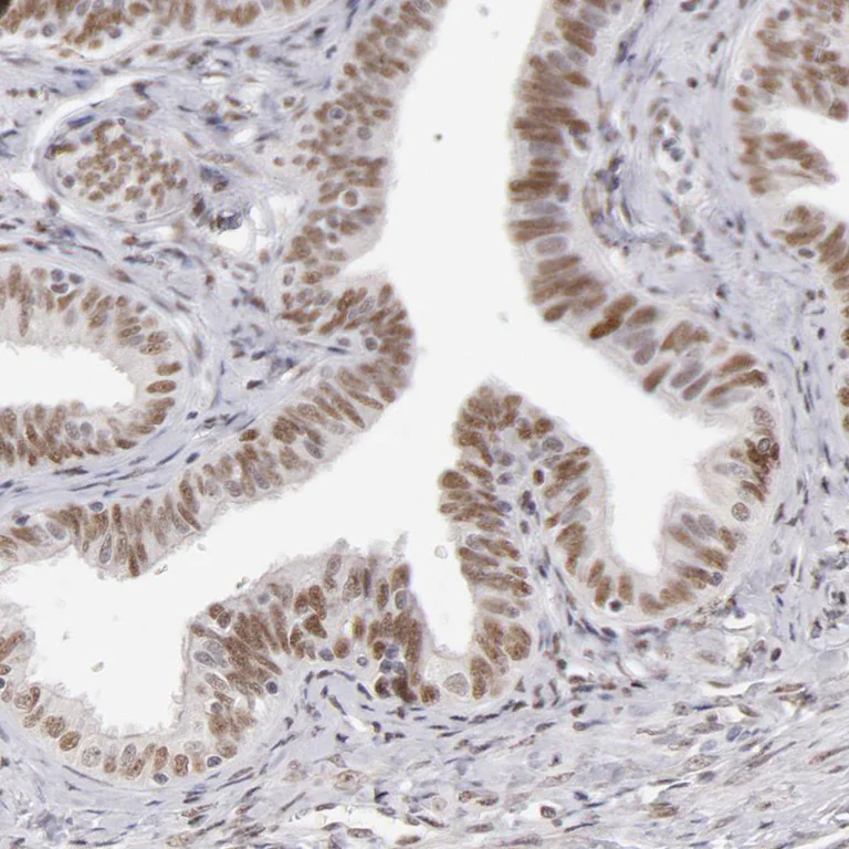 Immunohistochemistry (Formalin/PFA-fixed paraffin-embedded sections) - Anti-TFAP4 antibody (AB223771)