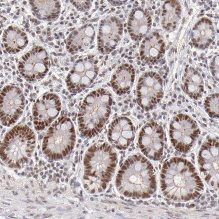 Immunohistochemistry (Formalin/PFA-fixed paraffin-embedded sections) - Anti-TFAP4 antibody (AB223771)