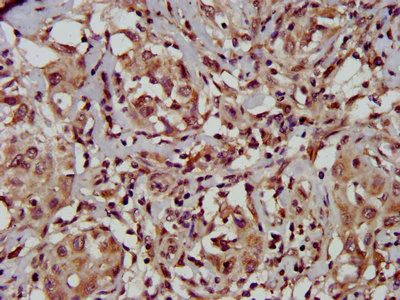 Immunohistochemistry (Formalin/PFA-fixed paraffin-embedded sections) - Anti-TFB1M antibody (AB236901)
