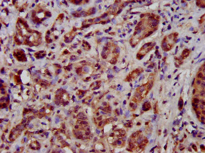 Immunohistochemistry (Formalin/PFA-fixed paraffin-embedded sections) - Anti-TFB1M antibody (AB236901)