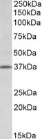 Western blot - Anti-TFB2M antibody (AB118321)