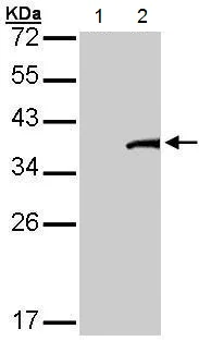 Western blot - Anti-TFB2M antibody (AB228614)
