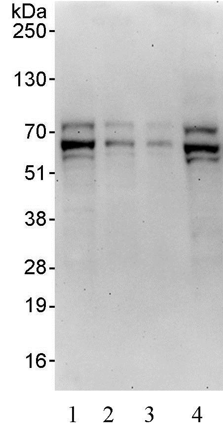 Western blot - Anti-TFE3 antibody (AB93808)