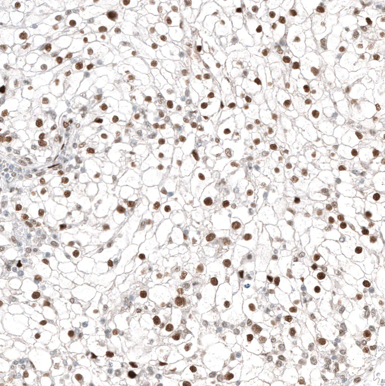 Immunohistochemistry (Formalin/PFA-fixed paraffin-embedded sections) - Anti-TFE3 Antibody [CL12810] (AB327142)