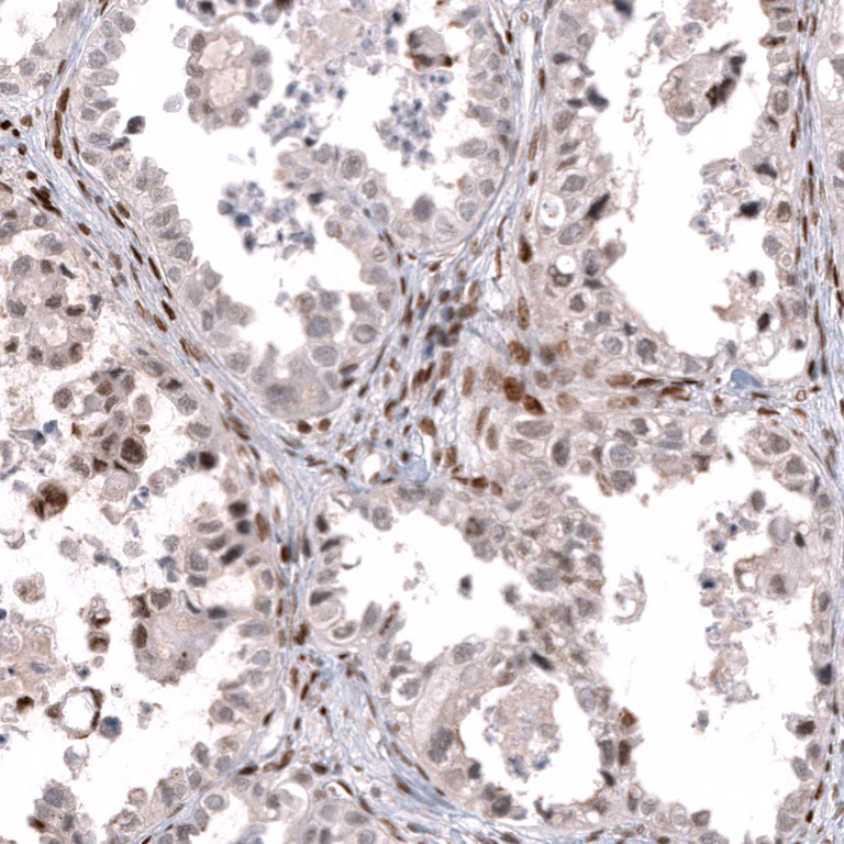 Immunohistochemistry (Formalin/PFA-fixed paraffin-embedded sections) - Anti-TFE3 Antibody [CL12810] (AB327142)