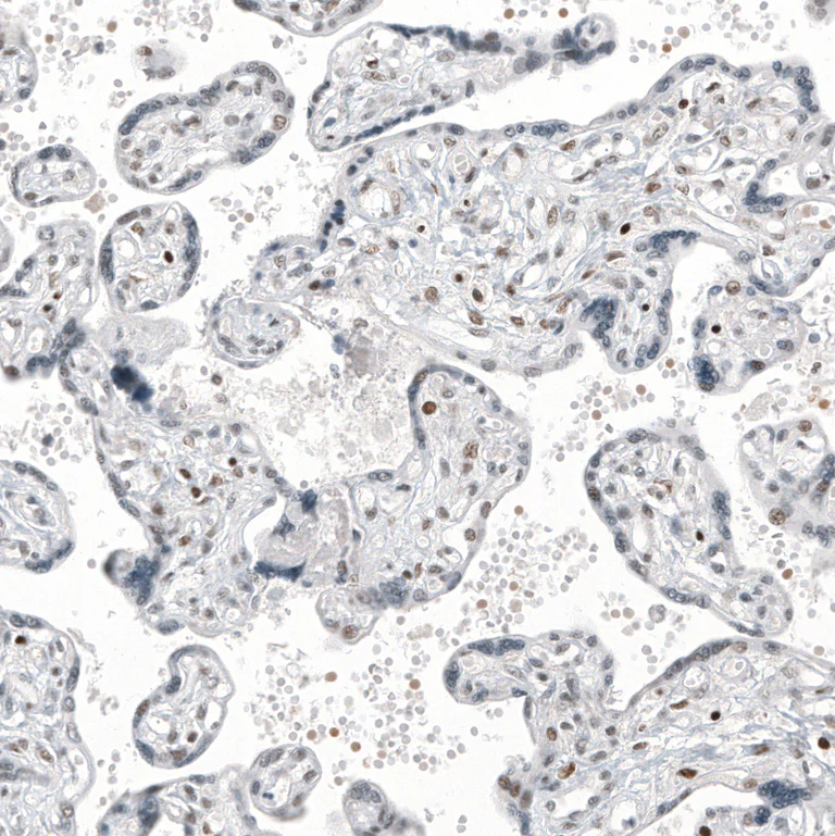 Immunohistochemistry (Formalin/PFA-fixed paraffin-embedded sections) - Anti-TFE3 Antibody [CL12810] (AB327142)