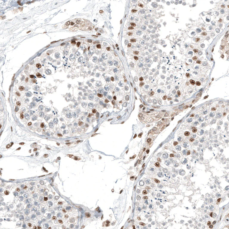 Immunohistochemistry (Formalin/PFA-fixed paraffin-embedded sections) - Anti-TFE3 Antibody [CL12810] (AB327142)