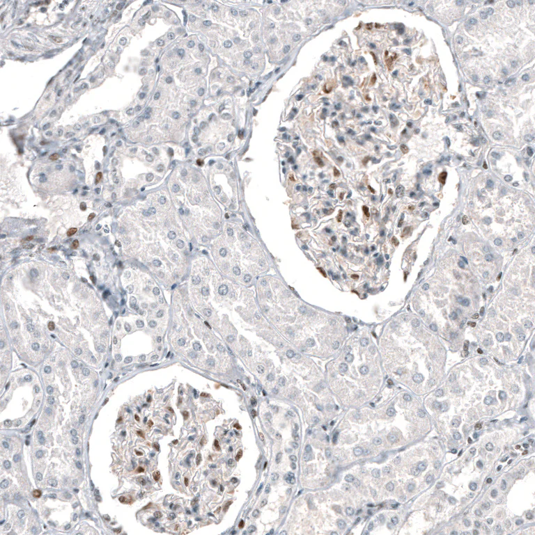 Immunohistochemistry (Formalin/PFA-fixed paraffin-embedded sections) - Anti-TFE3 Antibody [CL12810] (AB327142)