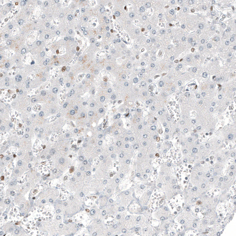 Immunohistochemistry (Formalin/PFA-fixed paraffin-embedded sections) - Anti-TFE3 Antibody [CL12810] (AB327142)