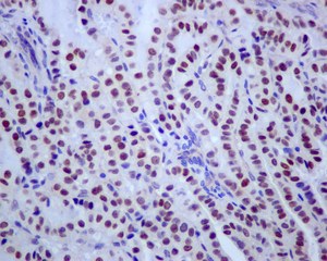 Immunohistochemistry (Formalin/PFA-fixed paraffin-embedded sections) - Anti-TFE3 antibody [EPR11591] (AB179804)