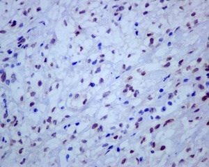 Immunohistochemistry (Formalin/PFA-fixed paraffin-embedded sections) - Anti-TFE3 antibody [EPR11591] - BSA and Azide free (AB231112), expandable thumbnail